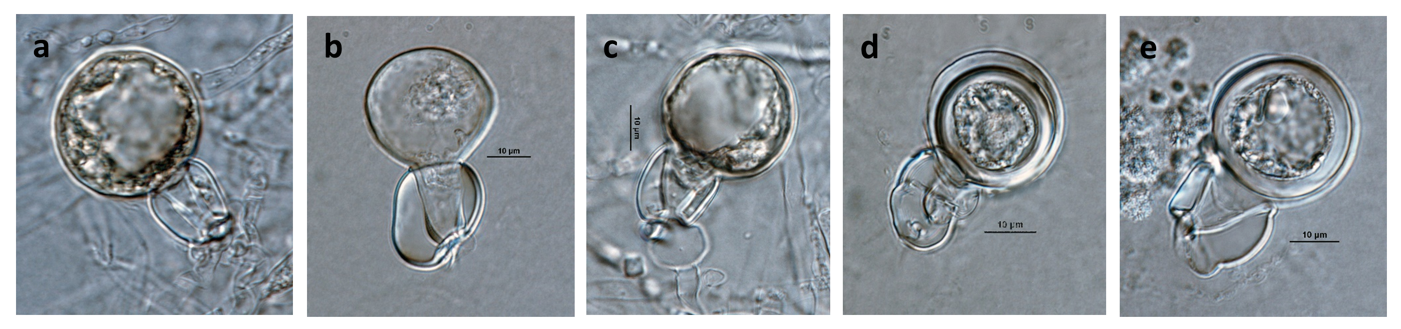   Phytophthora capsici nbsp;(ex-type CPHST BL 33) heterothallic sexual phase: (a, c) young oogonia with amphigynous antheridia, (d, e) smooth-walled oogonia with amphigynous antheridia (d, e), aplerotic oospore (d), plerotic oospore (e); photos by Gloria Abad, USDA-APHIS-PPQ. 
